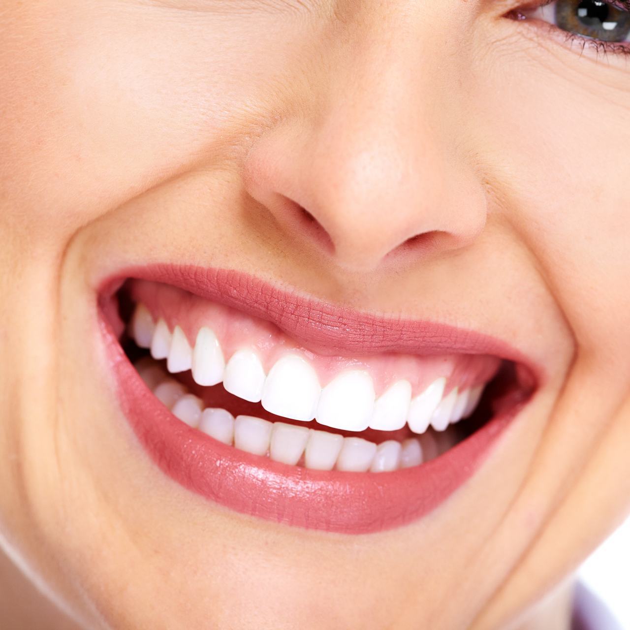 押上のオフィスホワイトニング