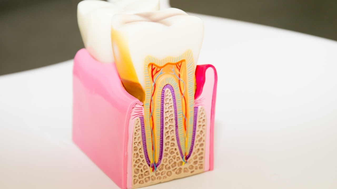 押上で歯ぎしり改善｜ナイトガードを使った治療