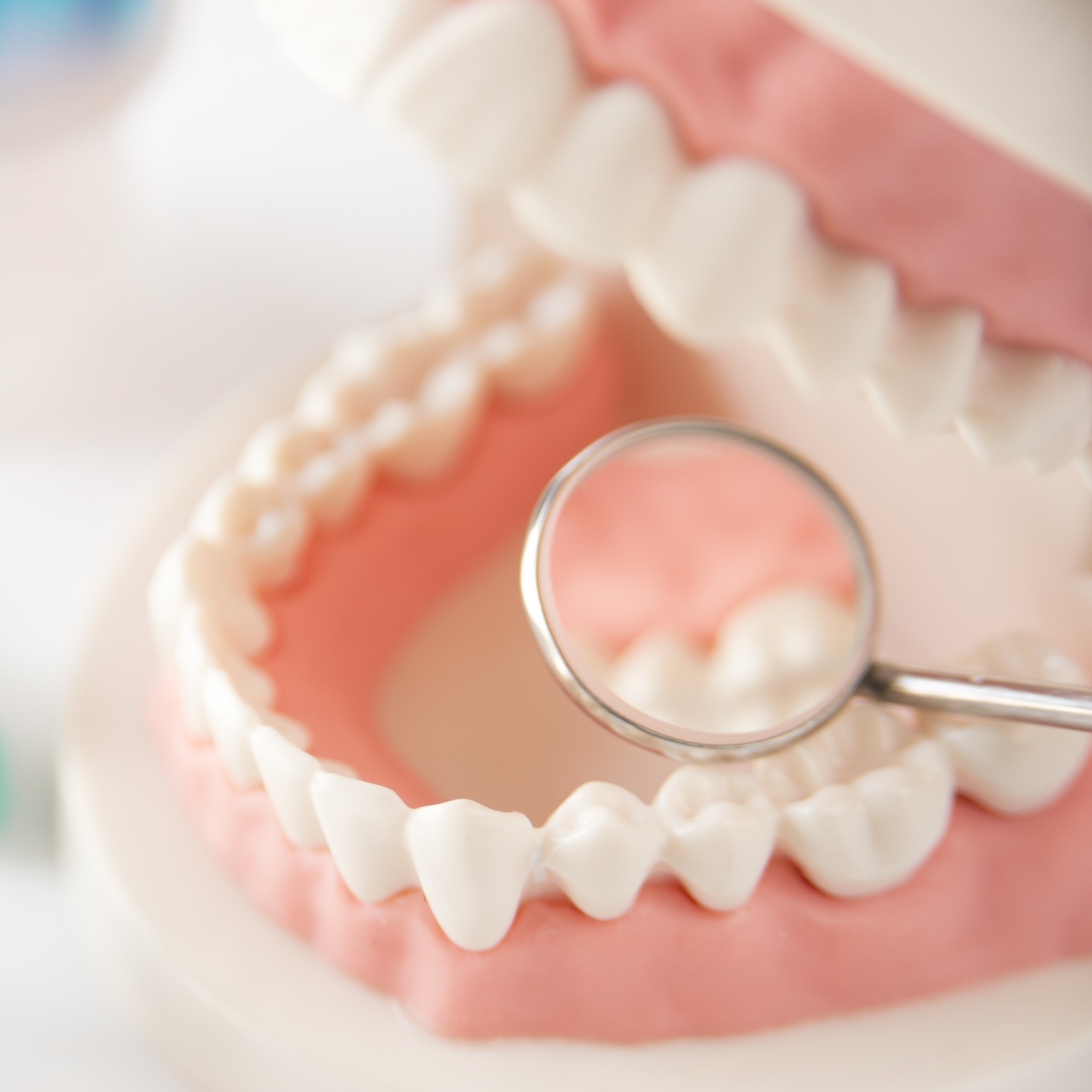 押上のホワイトニング