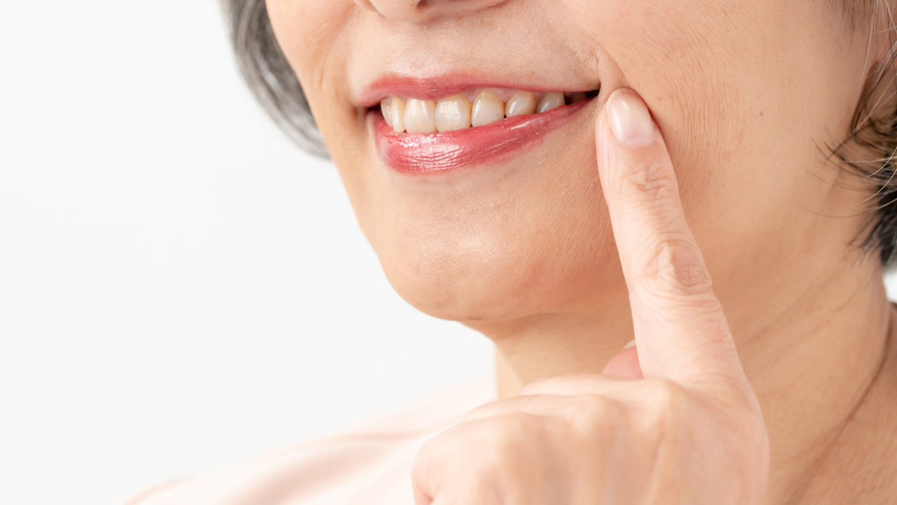 押上のノンクラスプデンチャー