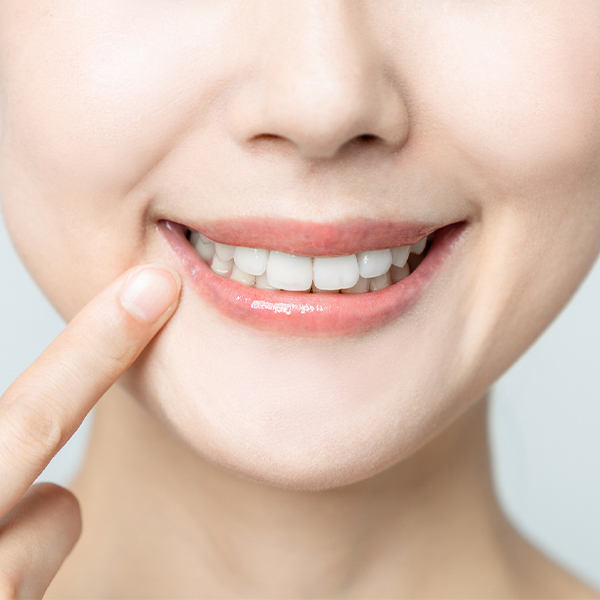 押上のホームホワイトニング