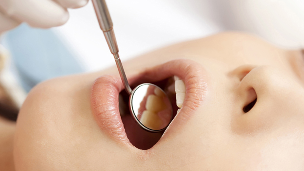 押上のホワイトニング