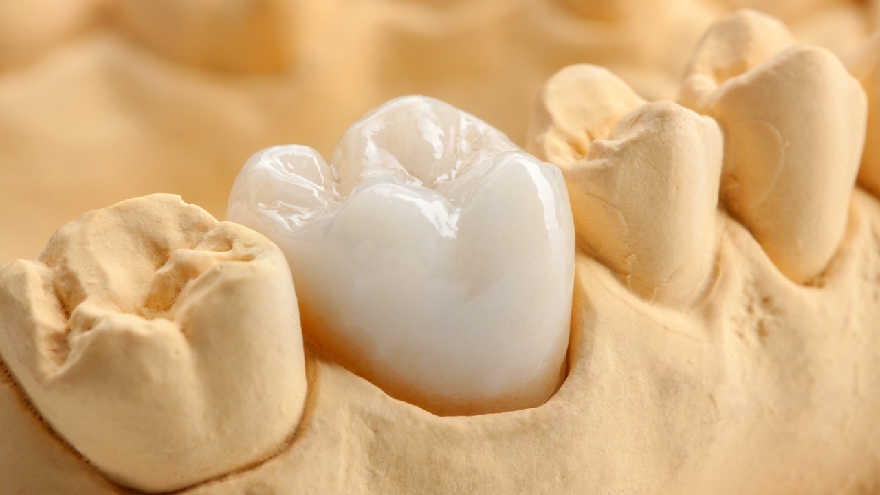 押上のなるべく歯を削らない治療