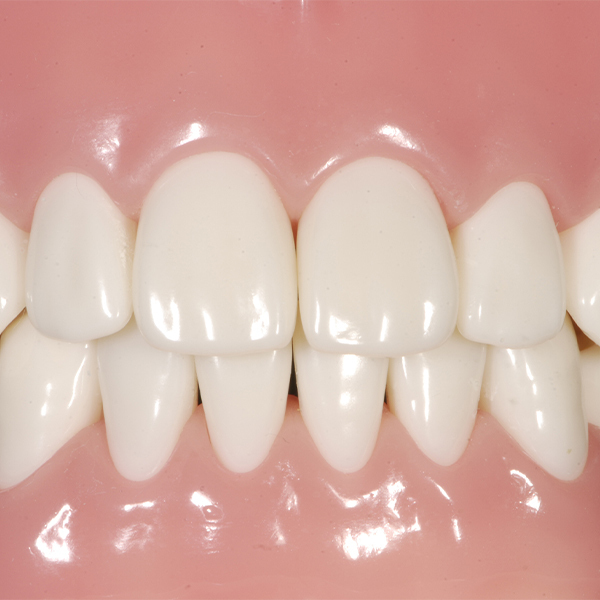 押上のウォーキングブリーチ