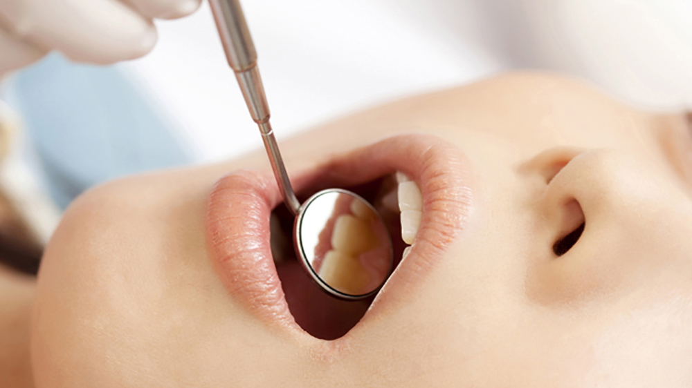 押上の予防歯科・定期検診