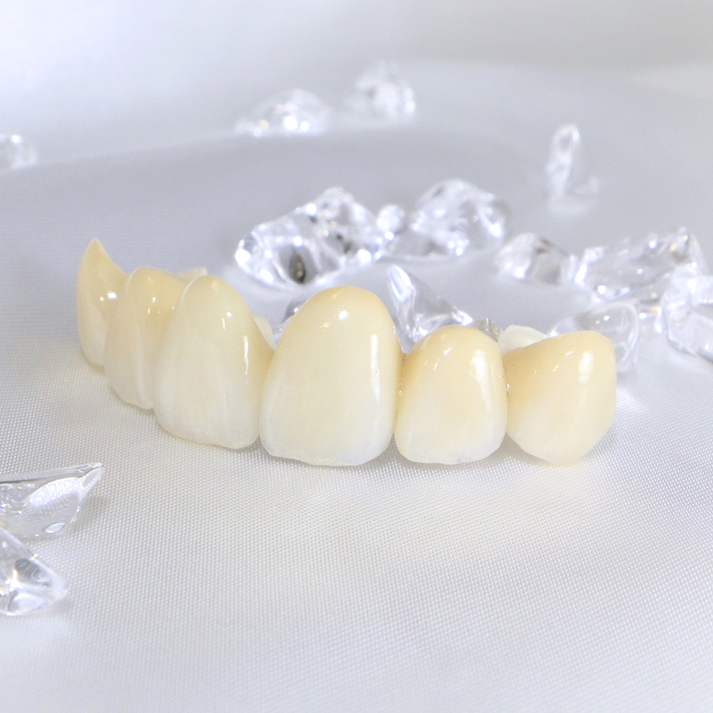 押上の審美歯科