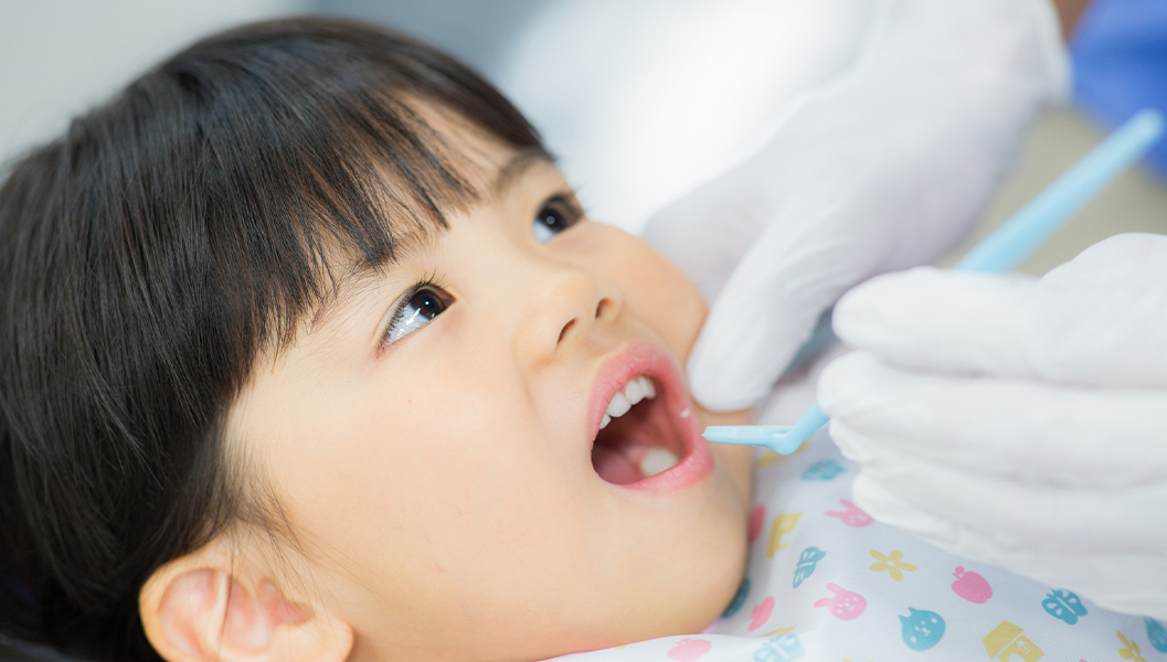 押上のシーラント