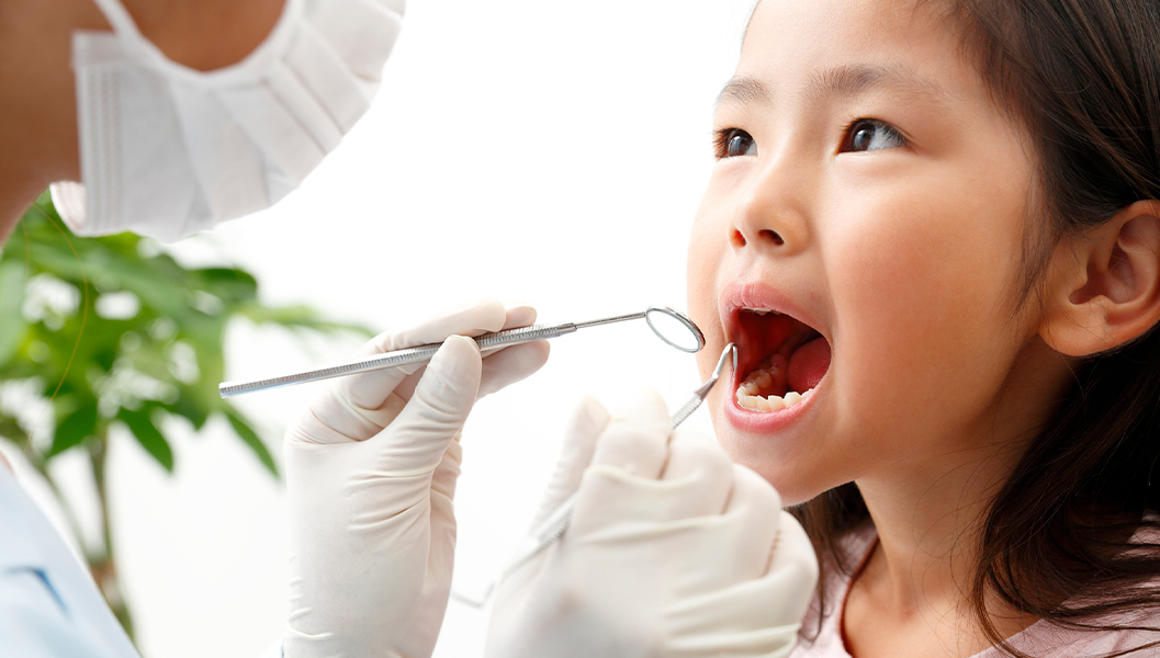 押上のシーラント