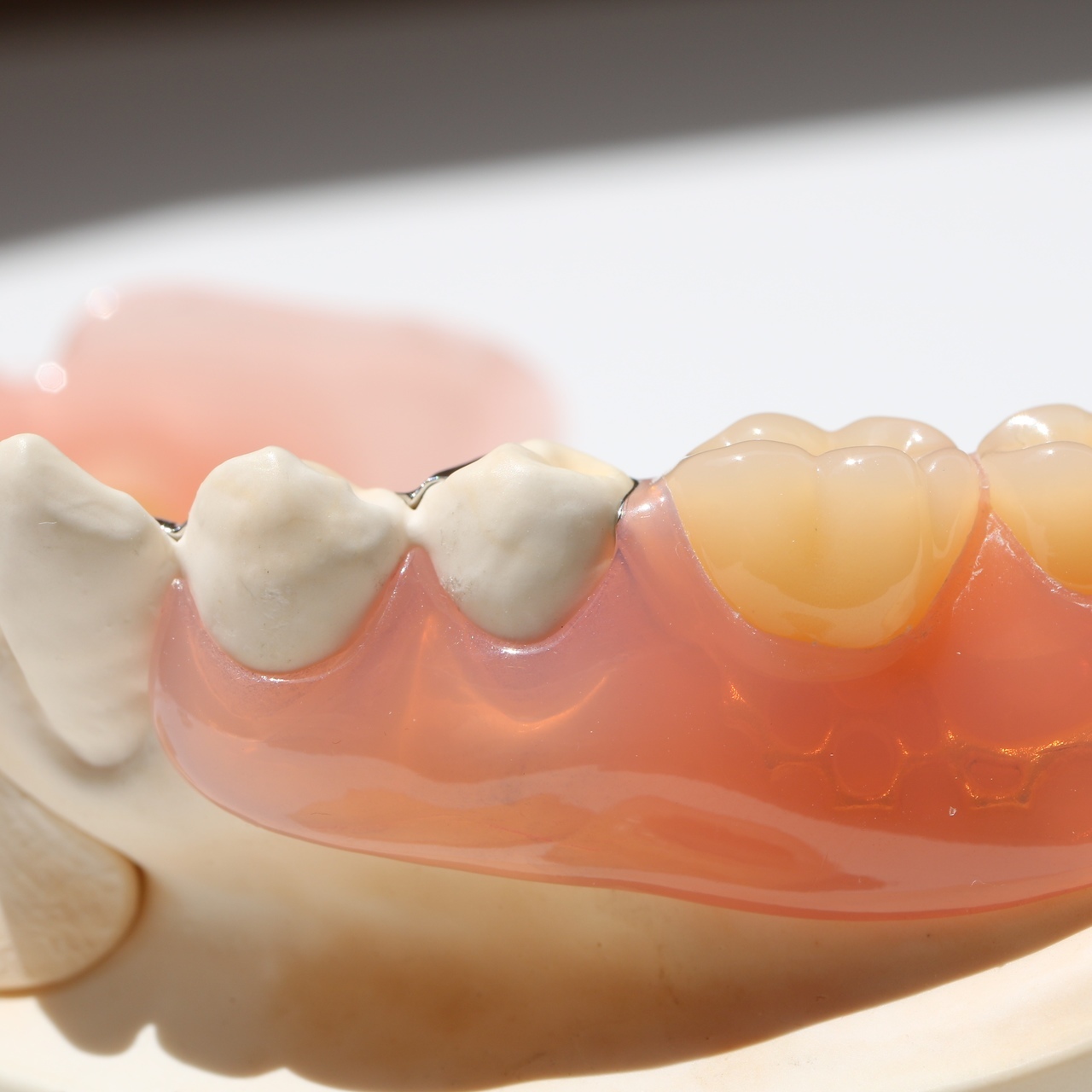 押上のノンクラスプデンチャー