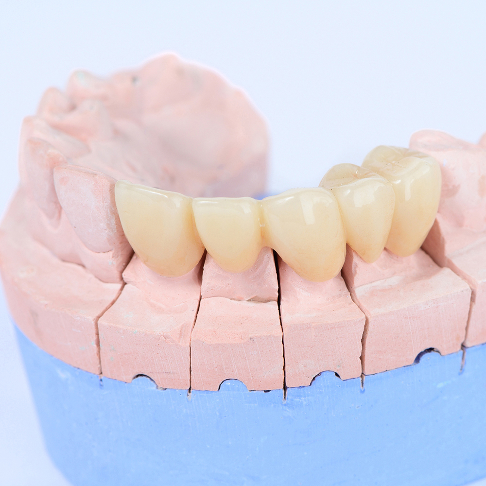 押上の審美歯科