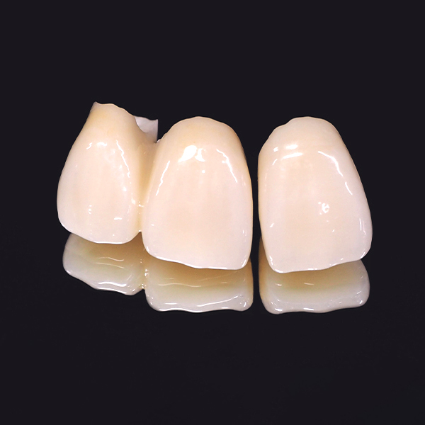 押上のセラミック治療