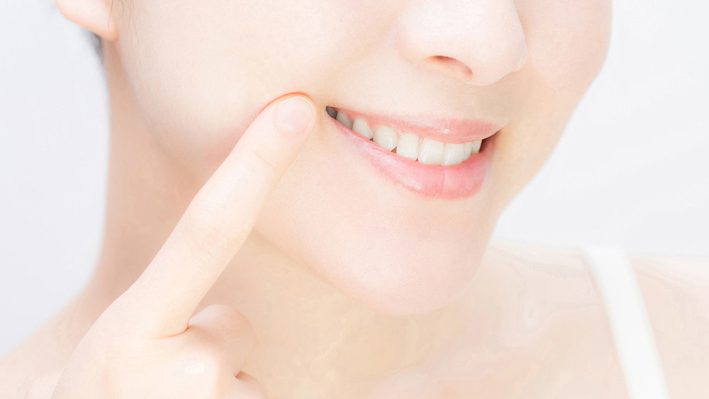 押上のホワイトニング