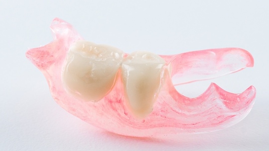 押上のノンクラスプデンチャー