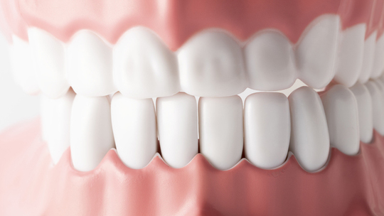 押上のマウスガード（スポーツ用マウスガード）