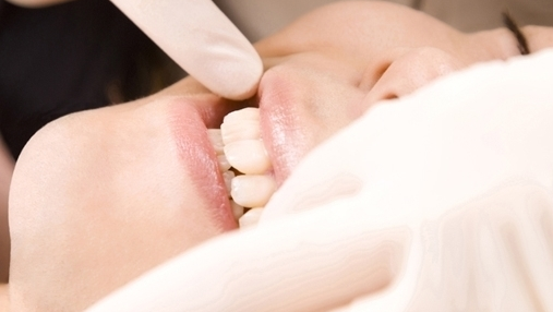 押上のホワイトニング