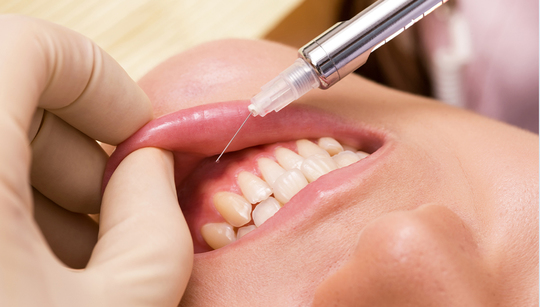 押上の痛みの少ない虫歯治療